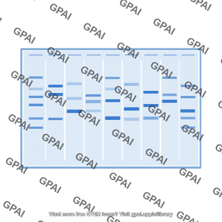 Protein electrophoresis gel