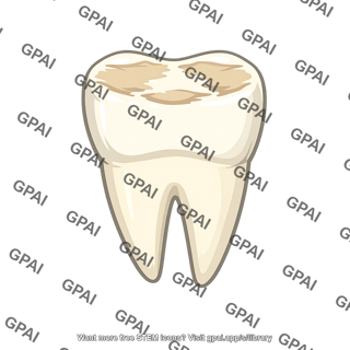 Tooth worn