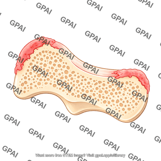 Mouse talus sagittal arthritic