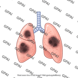 Mouse lungs diseased