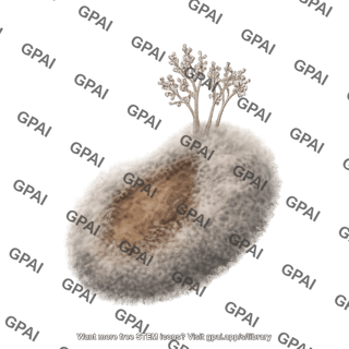 Botrytis