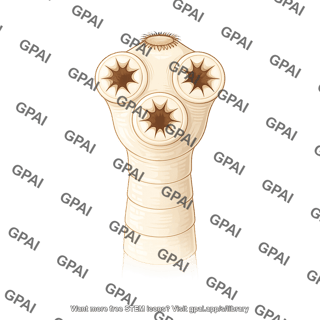 Rat tapeworm hymenolepis diminuta scolex
