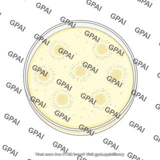 Petri dish plaque assay top view