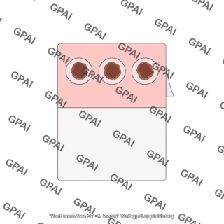 Fta card with sample
