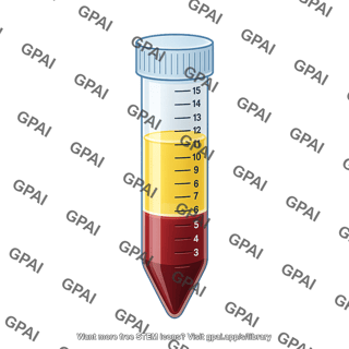 Falcon tube 15 ml blood after centrifugation 2 3 liquid with cap