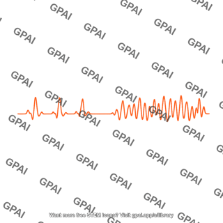 Ecg tracing ventricular fibrillation 2