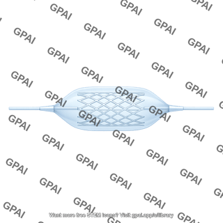 Angioplasty balloon inflated with stent