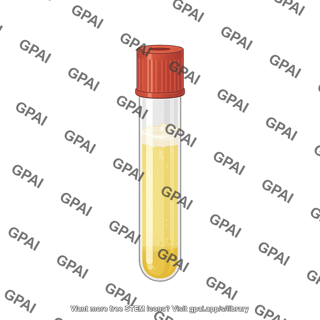 Vacutainer filled with draining fluid