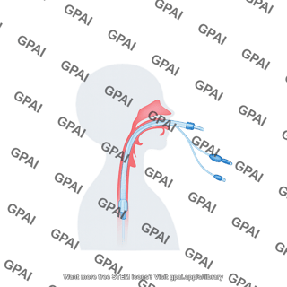 Tracheal tube on body