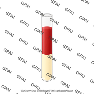 Cpt tube blood before centrifugation