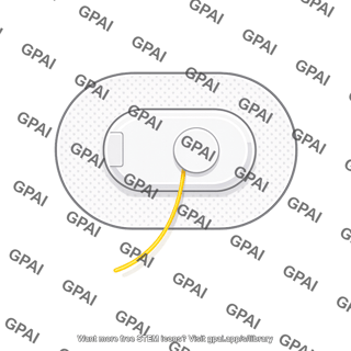Continuous glucose monitor with patch