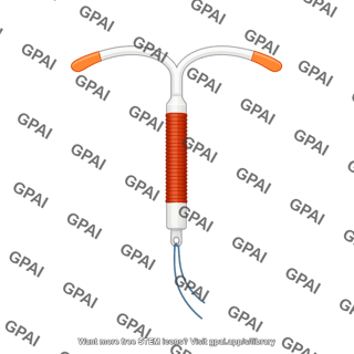 Intrauterine device