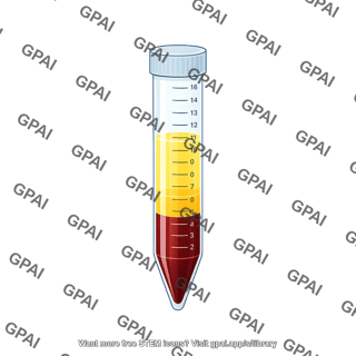 Falcon tube 15 ml blood after centrifugation 2 3 liquid