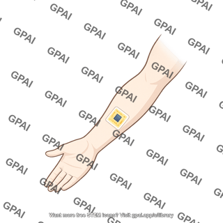 Arm with biosensor
