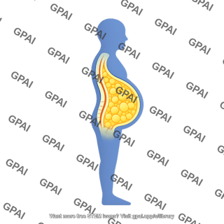 Person symbol lateral visceral adipose tissue