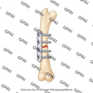 Fixation plate with screws in mouse femur anterior