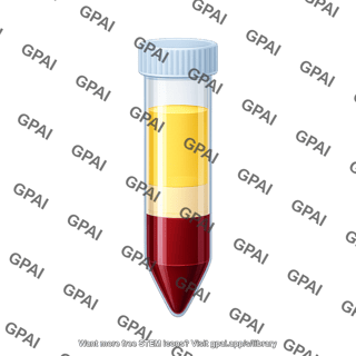 Falcon tube 50 ml blood after centrifugation