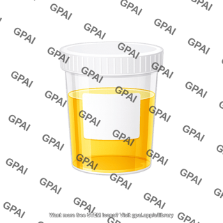 Urine sample with label