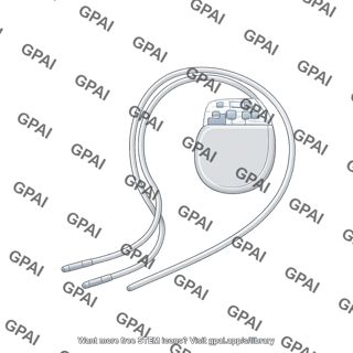Icd device with leads
