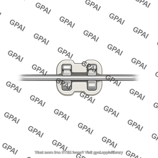 Dental braces bracket