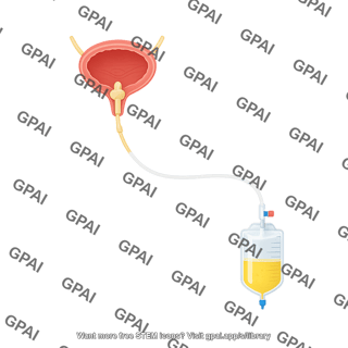 Foley catheter in bladder human