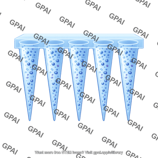 Microneedle hydrogel array with microspheres