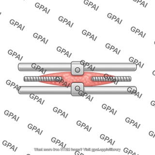 Hypertrophic scar device horizontal poles