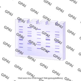 Gel electrophoresis with bands