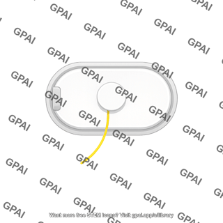 Continuous glucose monitor