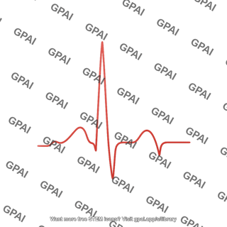 Ecg tracing ahcm labelled