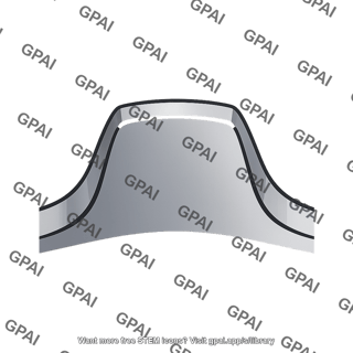Driven tooth tip