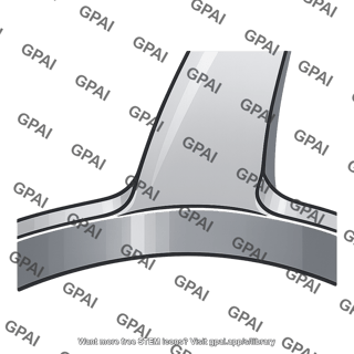 Gear tooth root fillet