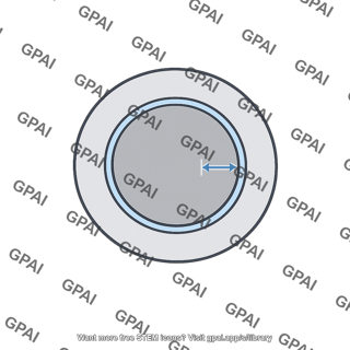 Radial clearance