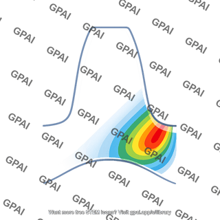 Photoelastic gear tooth