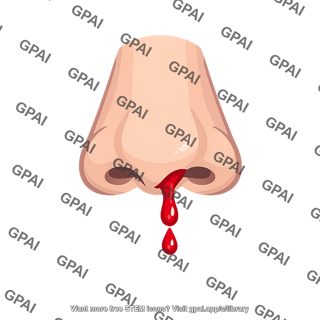 Nosebleed