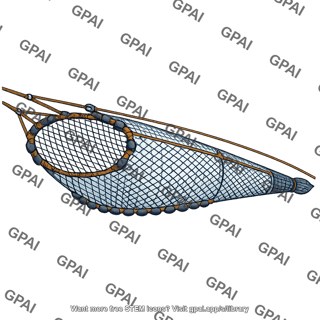 Trawl net