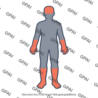 Minamata disease