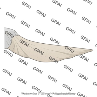 Submarine sediment apron
