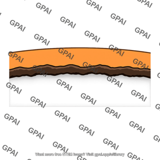 Core mantle boundary