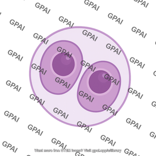 Reed sternberg cells