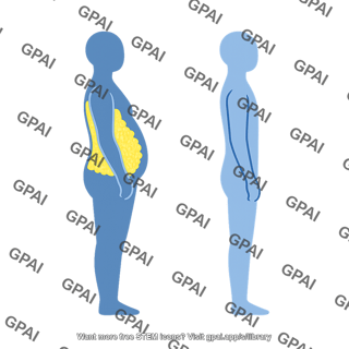 Person symbol lateral subcutaneous adipose tissue