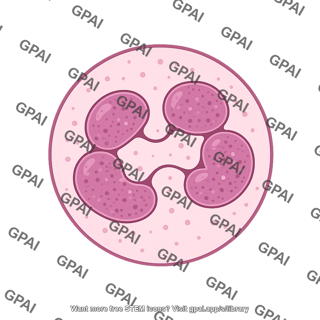 Neutrophil hypersegmented 02