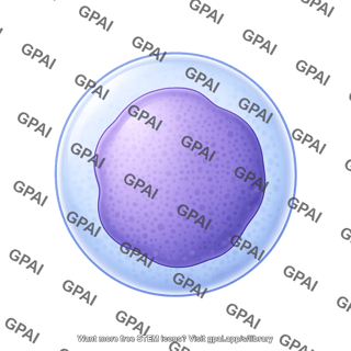 Lymphocyte neoplastic