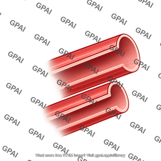 Vessel brush cut straight 02