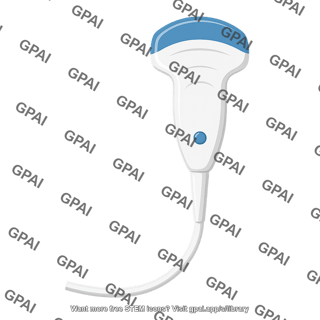 Ultrasound probe convex