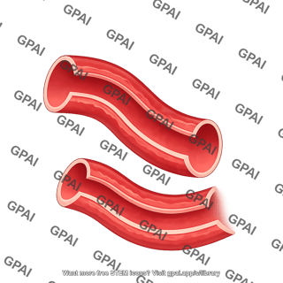 Vessel brush cut wavy 02