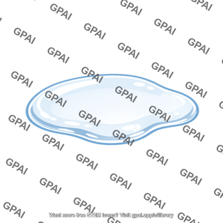 Liquid puddle