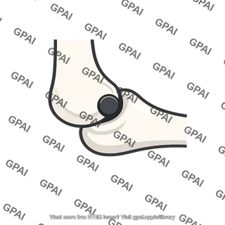 Elbow contact point