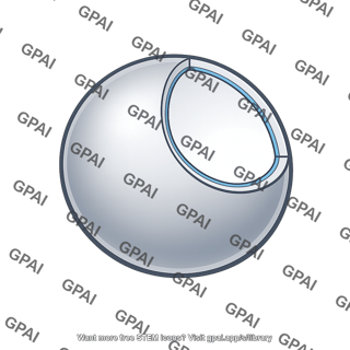 Thin spherical shell