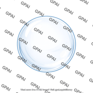 Glass ball
